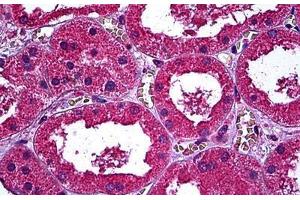 Human Kidney: Formalin-Fixed, Paraffin-Embedded (FFPE) (ERBB3 antibody  (AA 21-332))