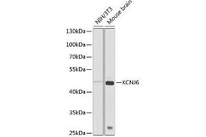 Western blot analysis of extracts of various cell lines using KCNJ6 Polyclonal Antibody at dilution of 1:1000. (KCNJ6 antibody)
