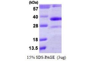 SDS-PAGE (SDS) image for Dehydrogenase/reductase (SDR Family) Member 4 (DHRS4) (AA 1-278) protein (His tag) (ABIN6386857) (DHRS4 Protein (AA 1-278) (His tag))