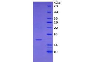 Western Blotting (WB) image for Insulin-Like Growth Factor 1 (IGF1) ELISA Kit (ABIN6730923)