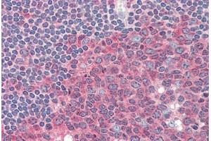 anti-Pyruvate Kinase, Muscle (PKM) antibody