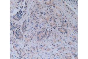 IHC-P analysis of Human Prostate Gland Tissue, with DAB staining. (TICAM1 antibody  (AA 443-685))