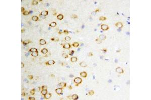 IHC-P: GDNF antibody testing of rat brain tissue