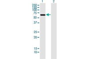 Western Blot analysis of AAAS expression in transfected 293T cell line by AAAS monoclonal antibody (M02), clone 5A1. (Adracalin antibody  (AA 1-100))