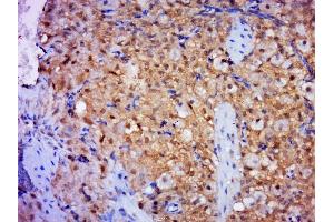 Paraformaldehyde-fixed, paraffin embedded mouse placenta, Antigen retrieval by boiling in sodium citrate buffer (pH6. (SNX6 antibody  (AA 211-310))
