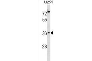 POPDC3 Antikörper  (C-Term)