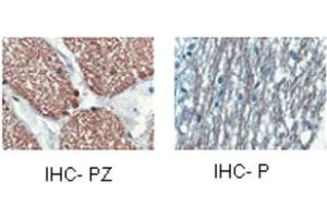 Immunohistochemistry (IHC) image for anti-2',3'-Cyclic Nucleotide 3' phosphodiesterase (CNP) (Middle Region) antibody (ABIN2778174)