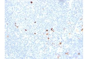 Formalin-fixed, paraffin-embedded human tonsil stained with IgM Recombinant Mouse Monoclonal Antibody (rIGHM/1623). (Recombinant IGHM antibody)