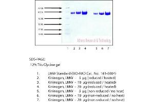 Gel Scan of Kininogen, LMW, Human Plasma  This information is representative of the product ART prepares, but is not lot specific. (LMW Kininogen Protein)