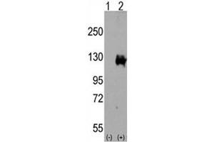 Western blot analysis of TRPM8 antibody and 293 cell lysate either nontransfected (Lane 1) or transiently transfected with the TRPM8 gene (2).