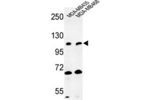 Western Blotting (WB) image for anti-Exostoses (Multiple)-Like 3 (EXTL3) antibody (ABIN3004013)