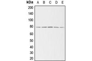 Western blot analysis of Gamma-adducin expression in HeLa (A), NIH3T3 (B), H9C2 (C), A375 (D), K562 (E) whole cell lysates.