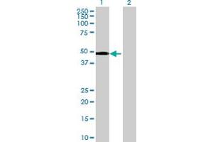Western Blot analysis of SNRNP48 expression in transfected 293T cell line by SNRNP48 MaxPab polyclonal antibody. (SNRNP48 antibody  (AA 1-339))