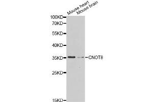 Western blot analysis of extracts of various cell lines, using CNOT8 Antibody.