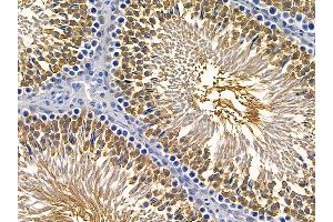 ABIN6257498 and ABIN6275600 at 1/100 staining rat testis tissue by IHC-P. (Sorting Nexin 1 antibody  (Internal Region))
