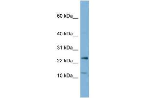 WB Suggested Anti-PPP1R11 Antibody Titration:  0. (PPP1R11 antibody  (N-Term))