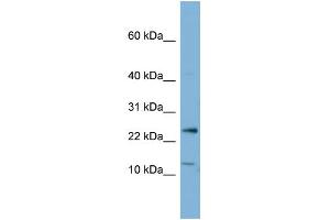 WB Suggested Anti-PPP1R11 Antibody Titration:  0.