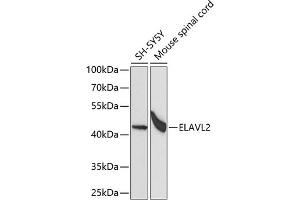 Western blot analysis of extracts of various cell lines, using EL antibody (ABIN6134649, ABIN6140114, ABIN6140116 and ABIN6221621) at 1:1000 dilution. (ELAVL2 antibody  (AA 1-100))