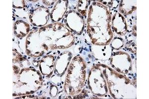 Immunohistochemistry (IHC) image for anti-Induced Myeloid Leukemia Cell Differentiation Protein Mcl-1 (MCL1) antibody (ABIN1499340) (MCL-1 antibody)