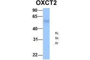 Host:  Rabbit  Target Name:  OXCT2  Sample Type:  Human Fetal Lung  Antibody Dilution:  1. (OXCT2 antibody  (Middle Region))