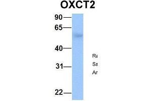 Host:  Rabbit  Target Name:  OXCT2  Sample Type:  Human Fetal Lung  Antibody Dilution:  1.