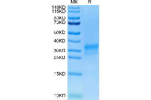Biotinylated Human Her2 Domain 4 on Tris-Bis PAGE under reduced condition. (ErbB2/Her2 Protein (AA 489-630) (His-Avi Tag,Biotin))
