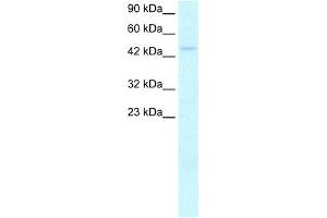 WB Suggested Anti-MYCN Antibody Titration:  2. (MYCN antibody  (C-Term))