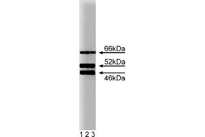 Western Blotting (WB) image for anti-SHC (Src Homology 2 Domain Containing) Transforming Protein 1 (SHC1) (AA 359-473) antibody (ABIN968229) (SHC1 antibody  (AA 359-473))