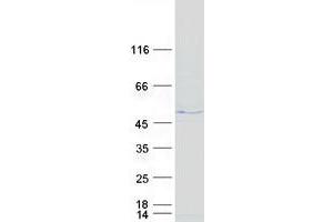 Testis Expressed 28 (TEX28) protein (Myc-DYKDDDDK Tag)
