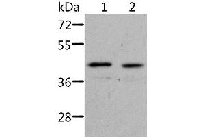 Western Blot analysis of Jurkat cell and Human fetal kidney tissue using NIF3L1 Polyclonal Antibody at dilution of 1:500 (NIF3L1 antibody)