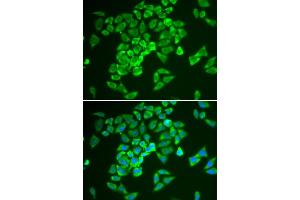 Immunofluorescence analysis of A549 cell using KEAP1 antibody. (KEAP1 antibody)