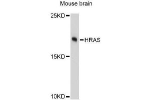 Western blot analysis of extracts of mouse brain, using HRAS Antibody.