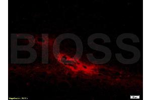 Formalin-fixed and paraffin embedded rat brain labeled with Anti-AANAT Polyclonal Antibody, Unconjugated (ABIN751063) at 1:200 followed by conjugation to the secondary antibody and DAB staining (AANAT antibody  (AA 141-207))