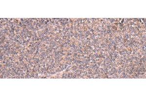 Immunohistochemistry of paraffin-embedded Human tonsil tissue using MRPS24 Polyclonal Antibody at dilution of 1:90(x200) (MRPS24 antibody)