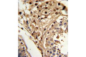 Immunohistochemistry (IHC) image for anti-Kruppel-Like Factor 6 (KLF6) antibody (ABIN3002701) (KLF6 antibody)