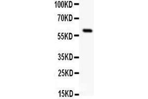 Anti-SSTR1 antibody, Western blotting All lanes: Anti SSTR1  at 0. (SSTR1 antibody  (C-Term))