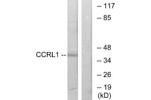 Western blot analysis of extracts from 293 cells, using CCRL1 antibody. (CCRL1 antibody  (N-Term))