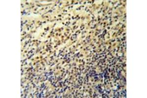 Immunohistochemistry analysis in tonsil (Formalin-fixed, Paraffin-embedded) using PLA2G7 Antibody , followed by peroxidase conjugated secondary antibody and DAB staining.