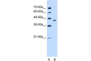 Western Blotting (WB) image for anti-Alcohol Dehydrogenase 1B (Class I), beta Polypeptide (ADH1B) antibody (ABIN2462475) (ADH1B antibody)