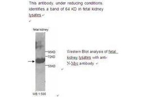 Image no. 1 for anti-N-Myc Proto-Oncogene Protein (MYCN) antibody (ABIN790800) (MYCN antibody)