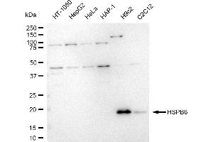 Western blotting analysis using HSPB6 antibody (ABIN7798877).