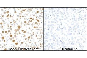 Immunohistochemistry (IHC) image for anti-Minichromosome Maintenance Complex Component 2 (MCM2) (pSer53) antibody (ABIN7449430)