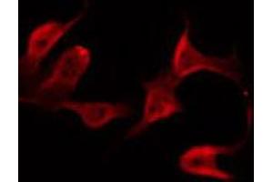 ABIN6272383 staining Hela by IF/ICC. (PDE4B/C/D antibody)
