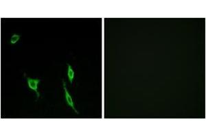 Immunofluorescence analysis of LOVO cells, using DCC Antibody.