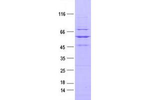 Western Blotting (WB) image for Receptor Tyrosine Kinase-Like Orphan Receptor 2 (ROR2) protein (DYKDDDDK Tag) (ABIN2731089)