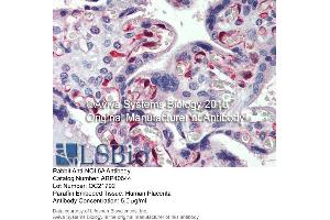 Immunohistochemistry (IHC) image for anti-NOP56 Ribonucleoprotein Homolog (NOP56) (Middle Region) antibody (ABIN2778982) (NOP56 antibody  (Middle Region))