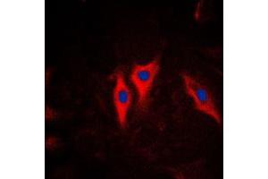 Immunofluorescent analysis of Cytokeratin 5 staining in HeLa cells. (Cytokeratin 5 antibody  (C-Term))