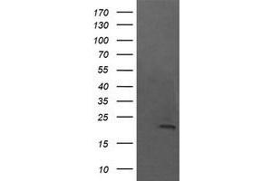 Image no. 1 for anti-NFKB Inhibitor Interacting Ras-Like 1 (NKIRAS1) antibody (ABIN1499741) (NKIRAS1 antibody)