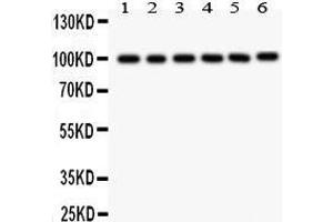 Anti- STIM1 Picoband antibody, Western blotting All lanes: Anti STIM1  at 0.