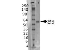 Western Blot analysis of Rat brain membrane lysate showing detection of VAChT protein using Mouse Anti-VAChT Monoclonal Antibody, Clone S6-38 . (SLC18A3 antibody  (AA 521-532) (FITC))